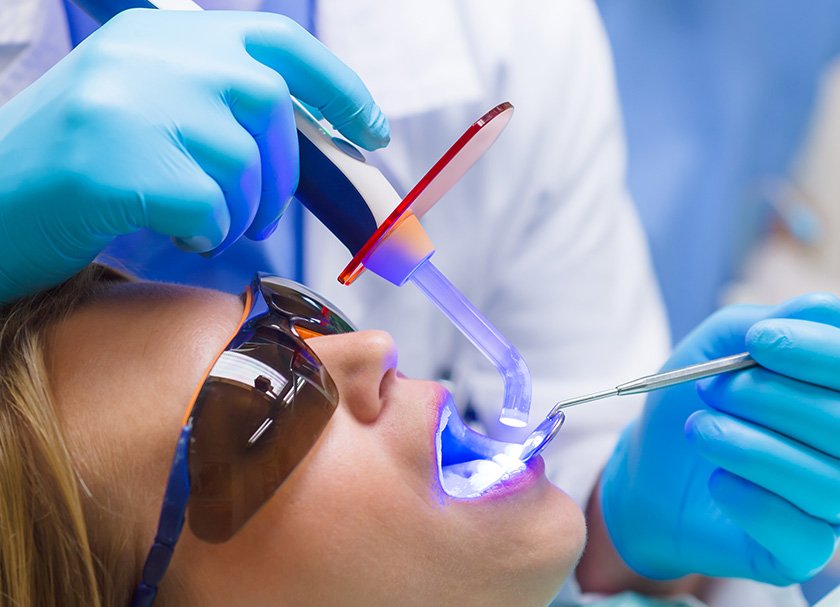 dental implants procedure and cost in delhi