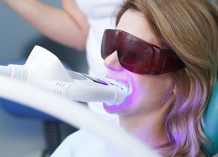 laser dental treatment delhi ncr