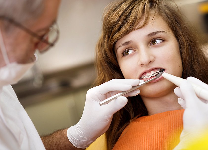 dental braces treatment in delhi