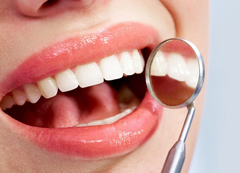 dentist teeth whitening delhi