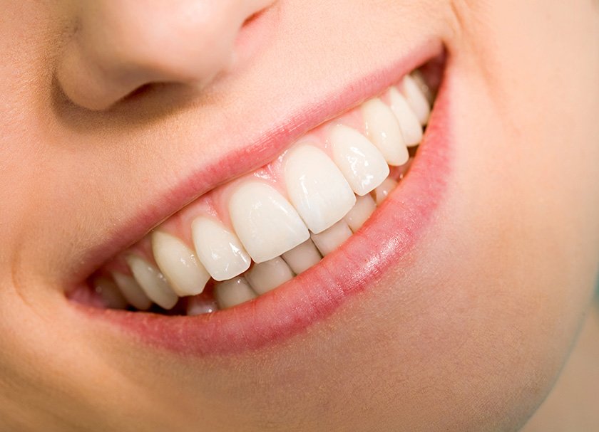 teeth whitening clinic in delhi