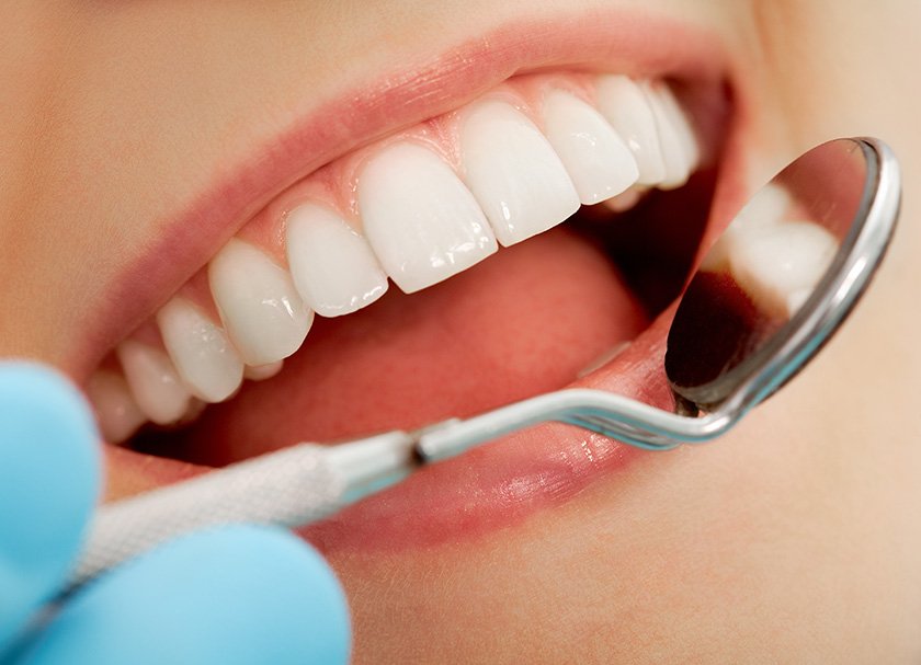 teeth whitening dentist in delhi