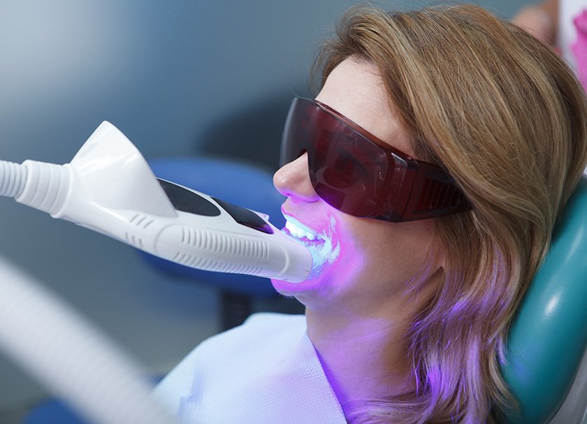 teeth whitening procedures cost dentist delhi