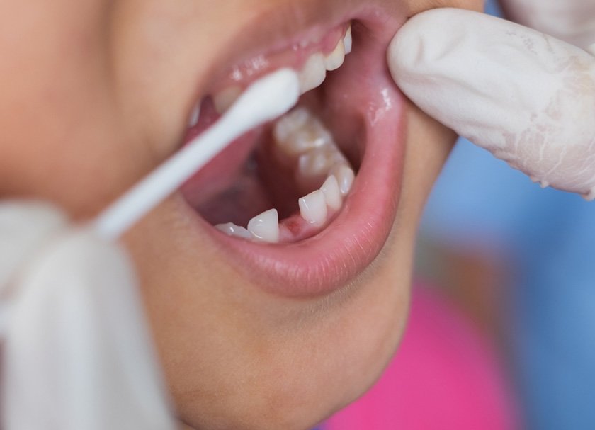 Preventive Dentistry​